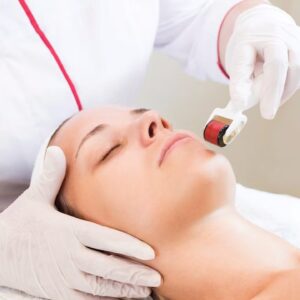 Microneedling médical
