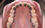 materiel orthodontique brackets fils accessoires dentaires
